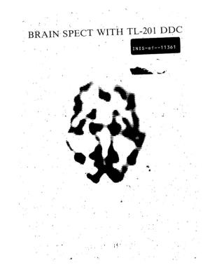 Brain Spect with Tl-201 Ddc