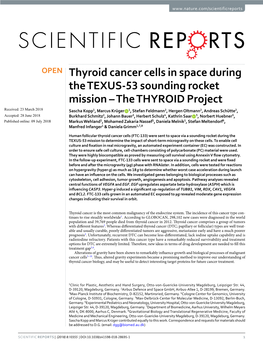 Thyroid Cancer Cells in Space During the TEXUS-53 Sounding Rocket