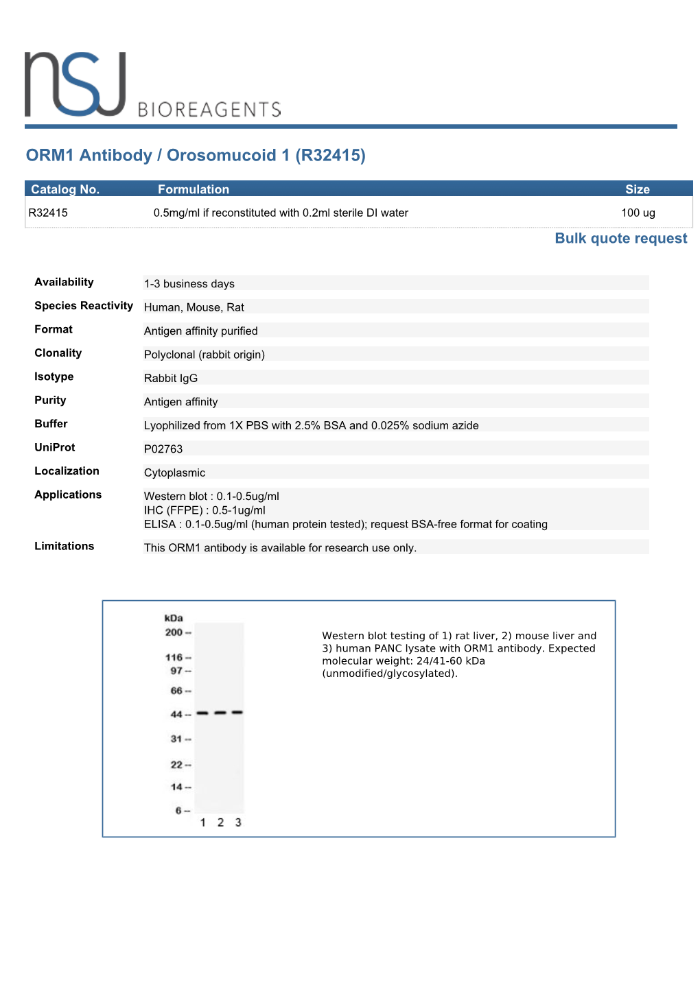 ORM1 Antibody / Orosomucoid 1 (R32415)