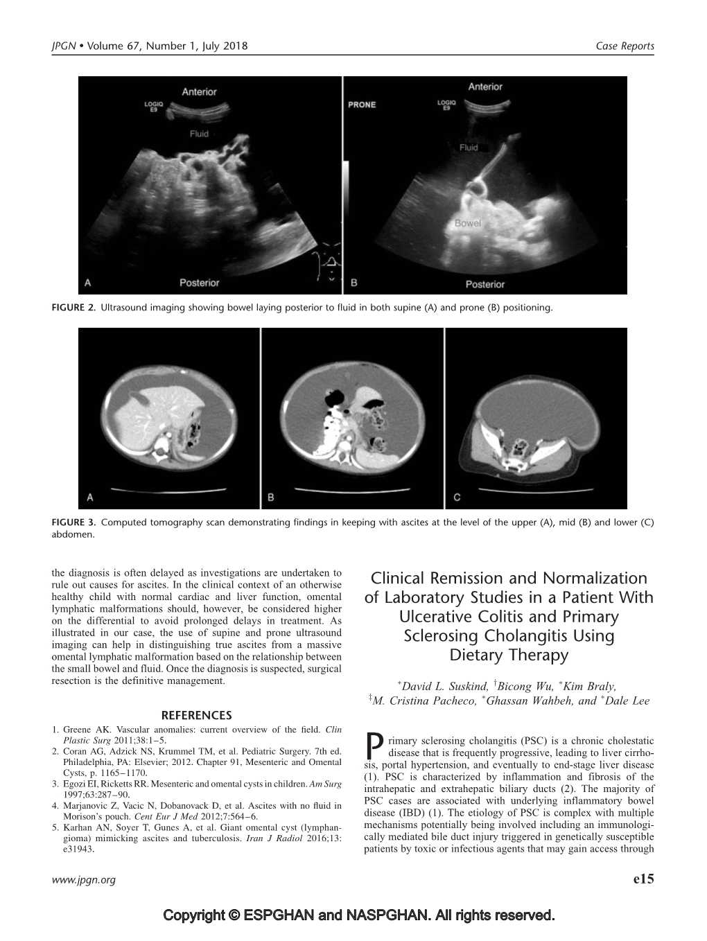 Clinical Remission and Normalization of Laboratory Studies in a Patient