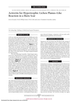 Acitretin for Hypertrophic Lichen Planus Like Reaction in a Burn Scar