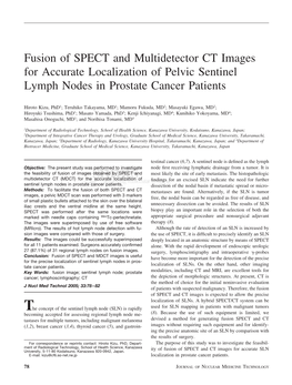 Fusion of SPECT and Multidetector CT Images for Accurate Localization of Pelvic Sentinel Lymph Nodes in Prostate Cancer Patients