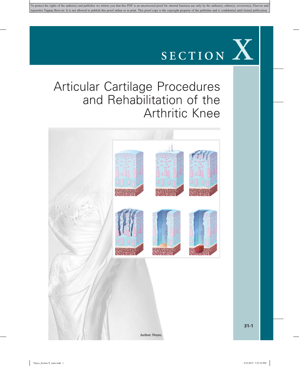 Articular Cartilage Procedures and Rehabilitation of the Arthritic Knee