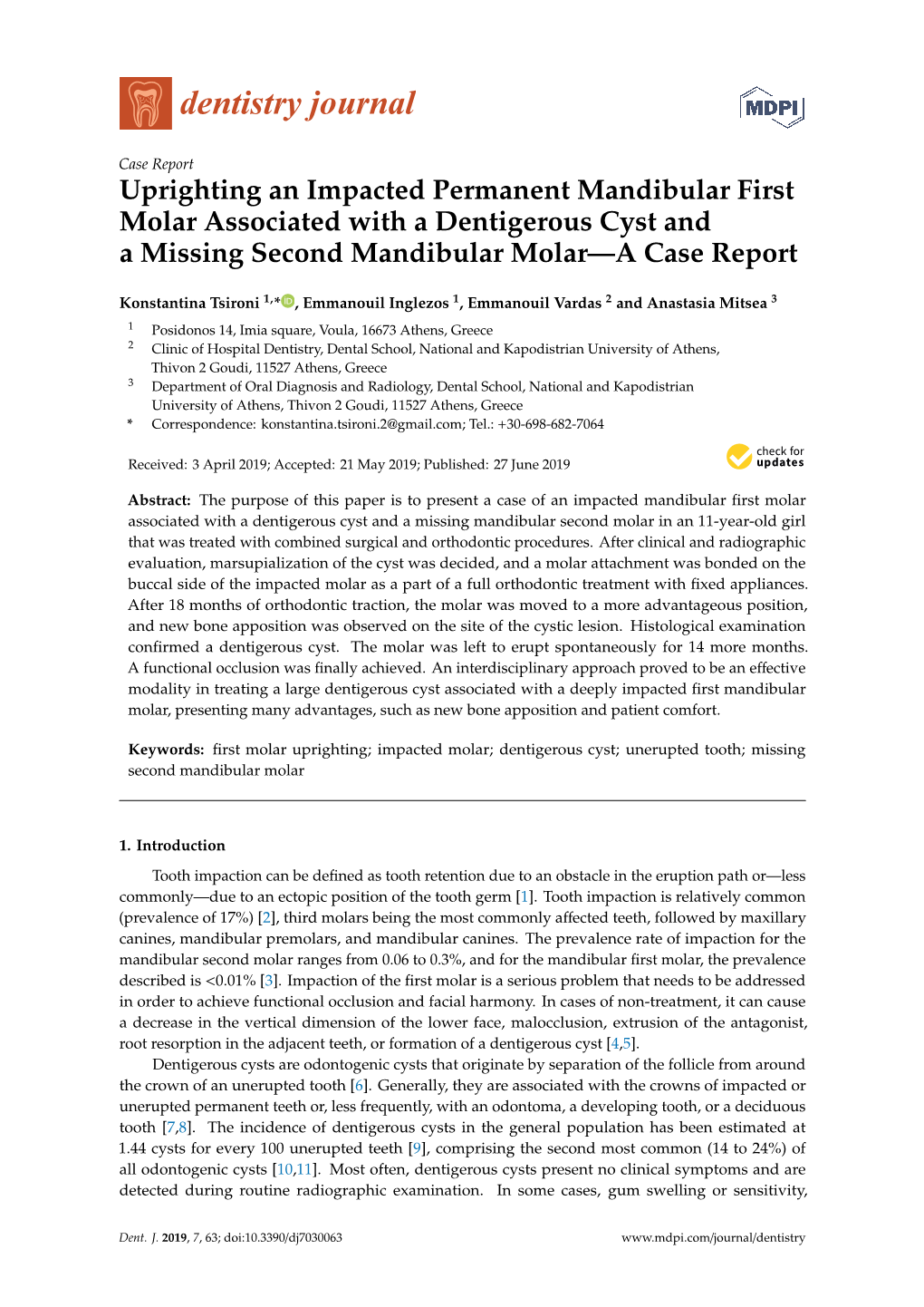 Uprighting an Impacted Permanent Mandibular First Molar Associated with a Dentigerous Cyst and a Missing Second Mandibular Molar—A Case Report