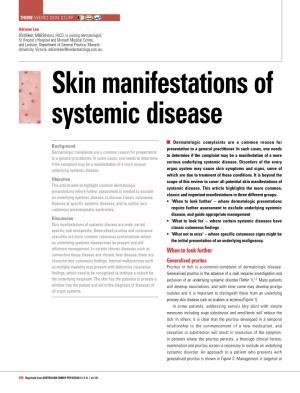Skin Manifestations of Systemic Disease