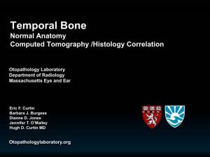 Temporal Bone, Normal Anatomy, Computed Tomography/Histology