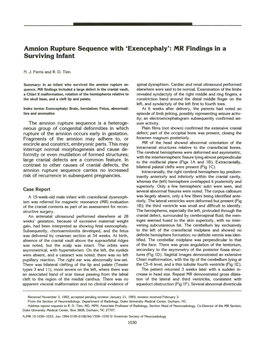 Amnion Rupture Sequence with 'Exencephaly': MR Findings in a Surviving Infant