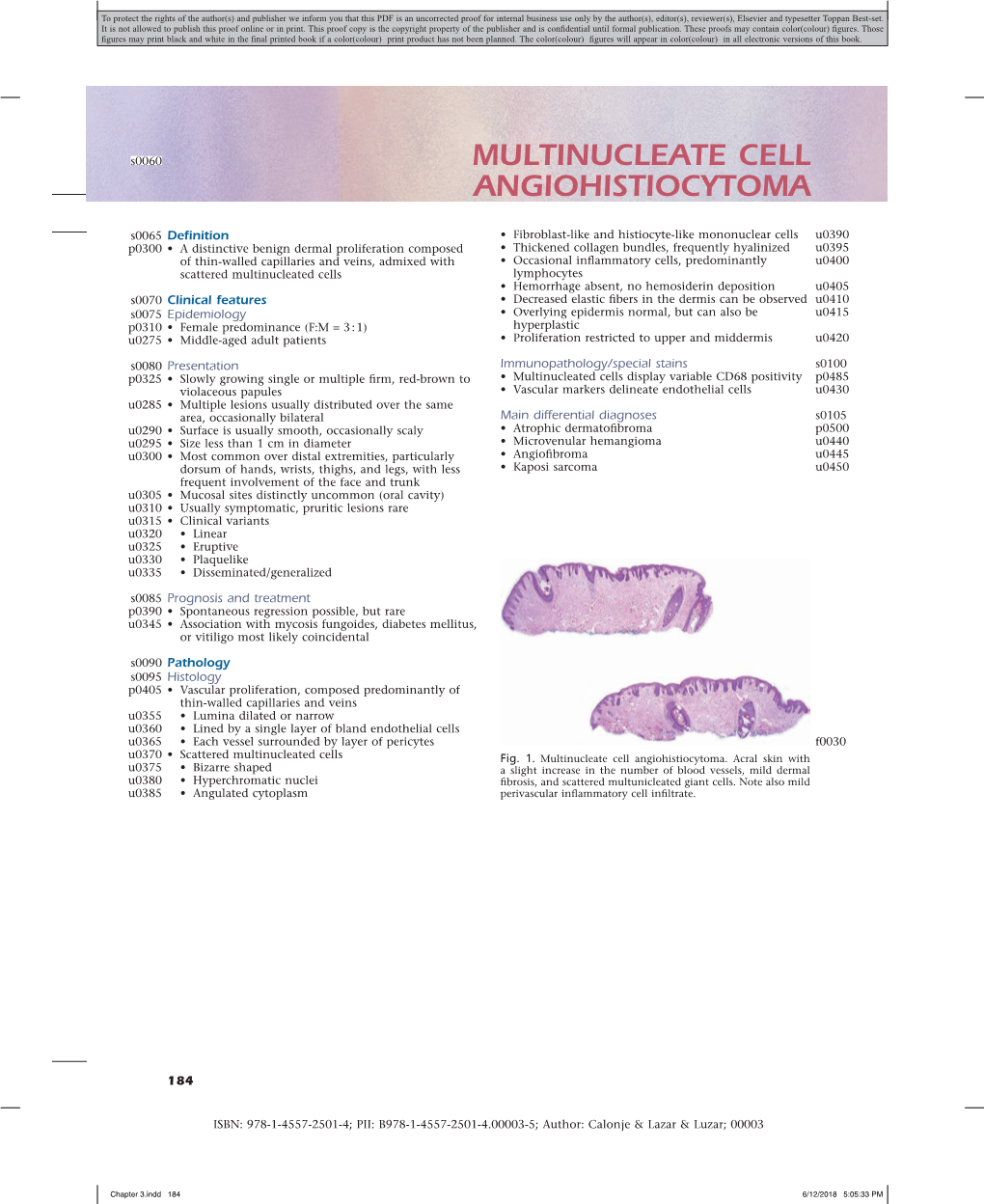 Multinucleate Cell Angiohistiocytoma