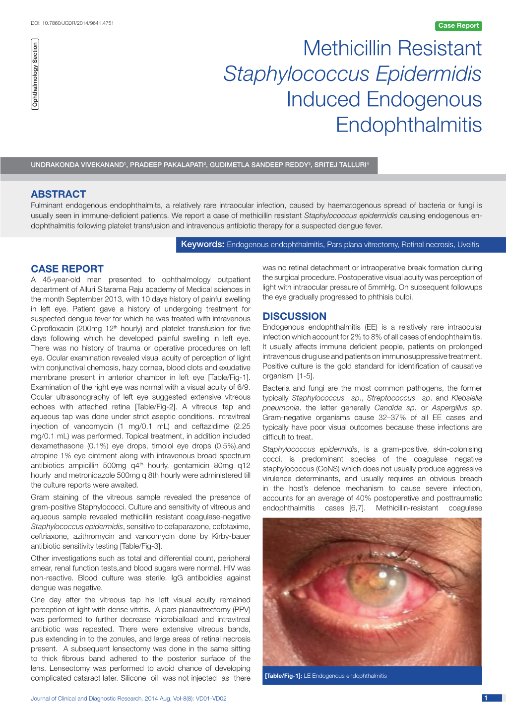 Methicillin Resistant Staphylococcus Epidermidis Induced Endogenous Endophthalmitis