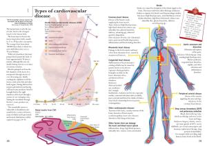 Types of Cardiovascular Disease