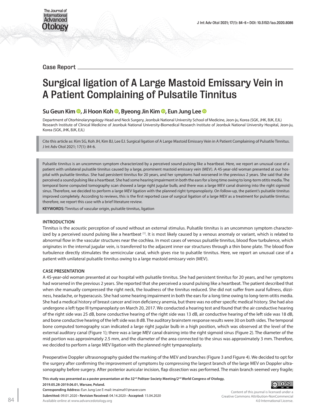 Surgical Ligation of a Large Mastoid Emissary Vein in a Patient Complaining of Pulsatile Tinnitus