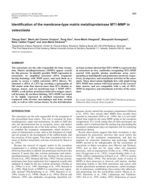 Identification of the Membrane-Type Matrix Metalloproteinase MT1-MMP