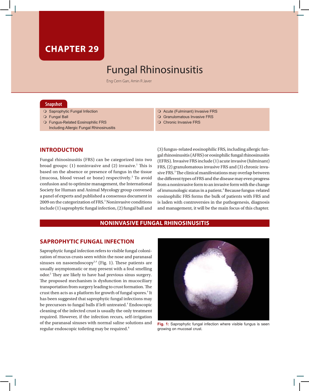 Fungal Rhinosinusitis Eng Cern Gan, Amin R Javer