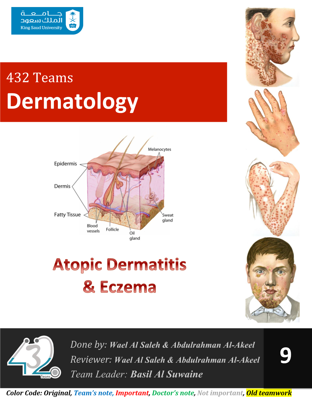 Seborrheic Dermatitis