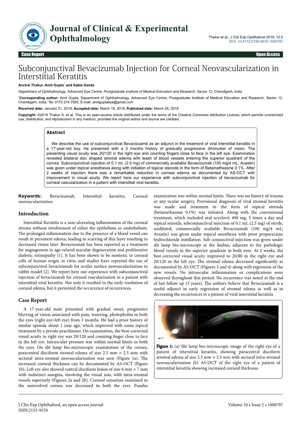 Subconjunctival Bevacizumab Injection for Corneal Neovascularization in Interstitial Keratitis