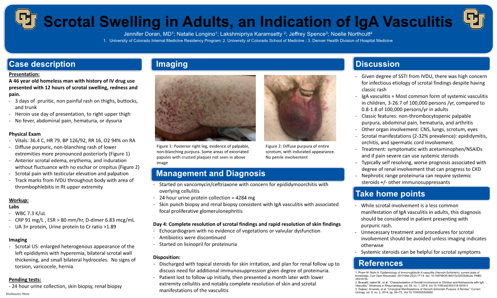 Scrotal Swelling in Adults, an Indication of Iga Vasculitis Jennifer Doran, MD1; Natalie Longino1; Lakshmipriya Karamsetty 2; Jeffrey Spence3; Noelle Northcutt4 1