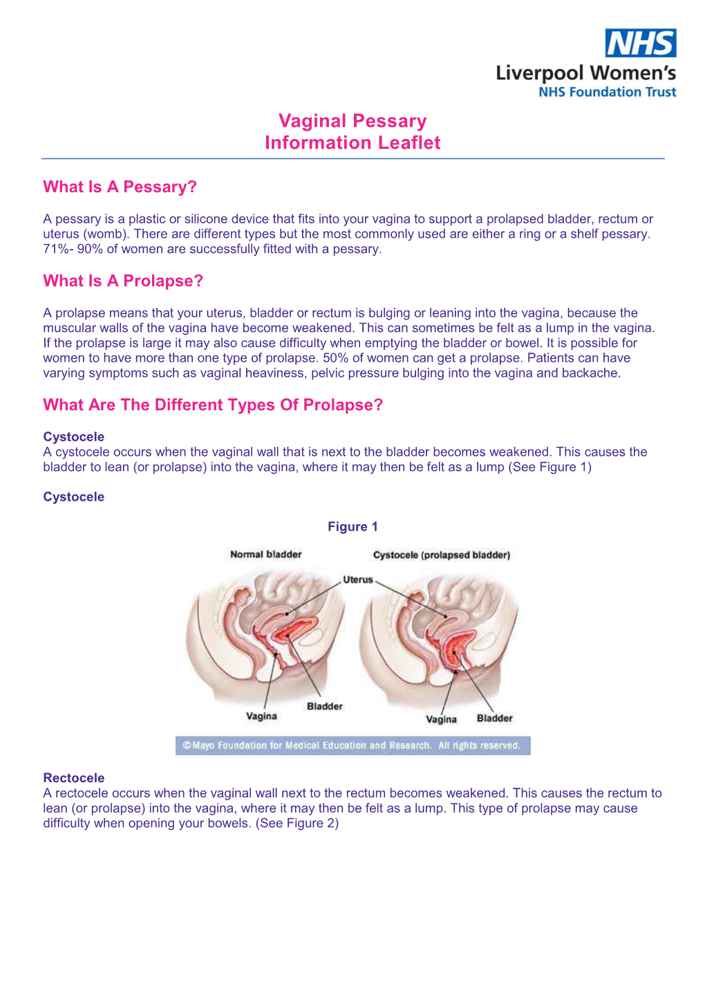 Uro 2018-159 Issue Date: 02/2015 Review Date: 03/2021 © Liverpool Women’S NHS Foundation Trust