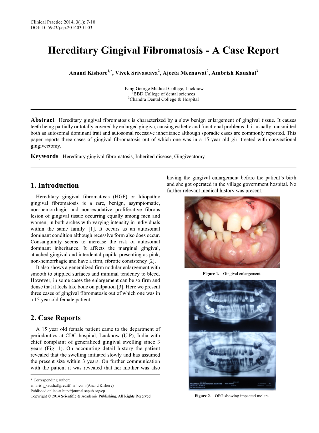 Hereditary Gingival Fibromatosis, Inherited Disease, Gingivectomy