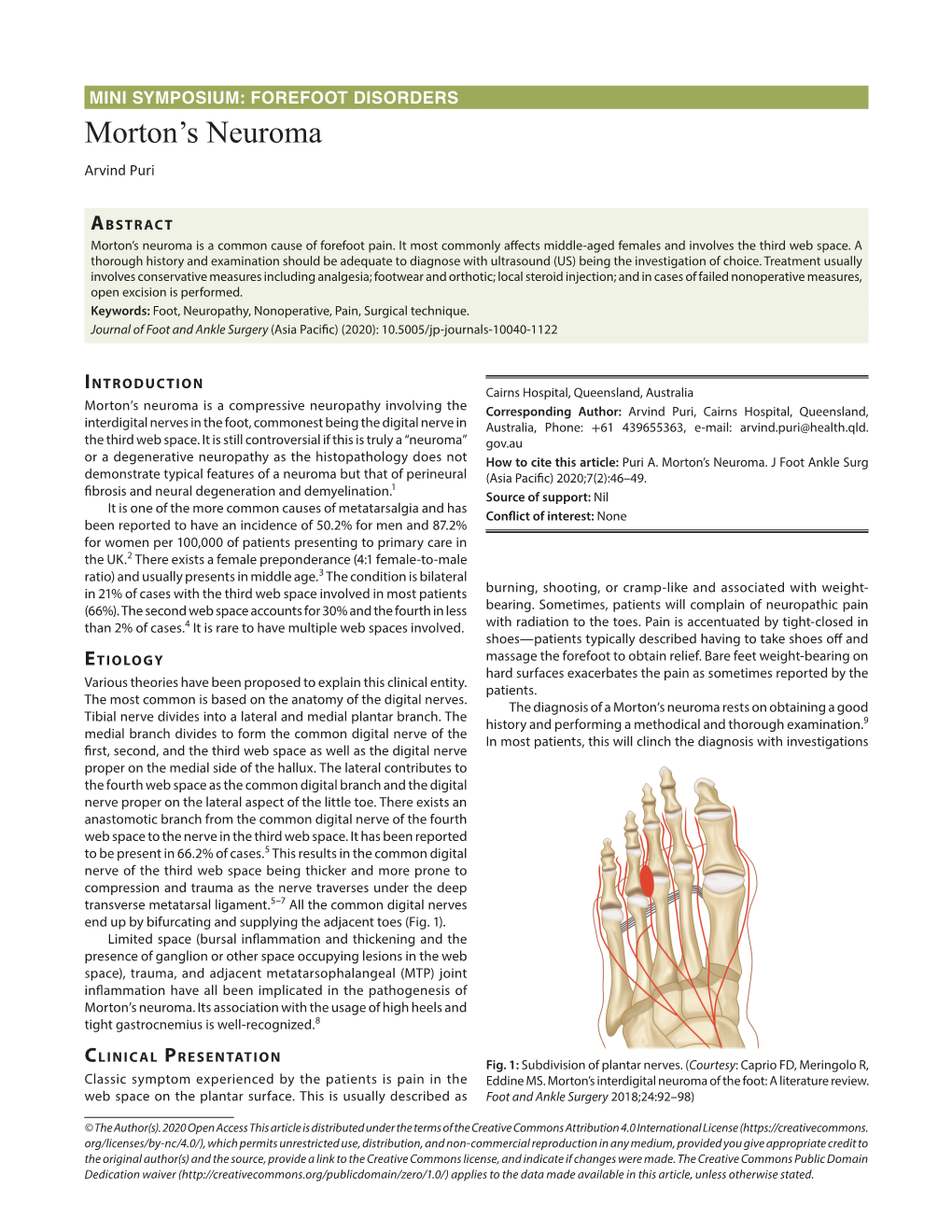 Morton's Neuroma