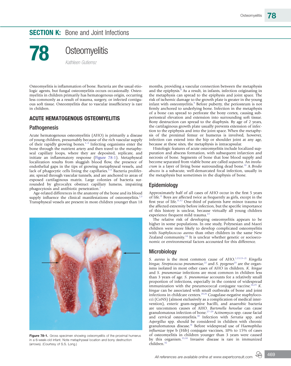 Osteomyelitis 78