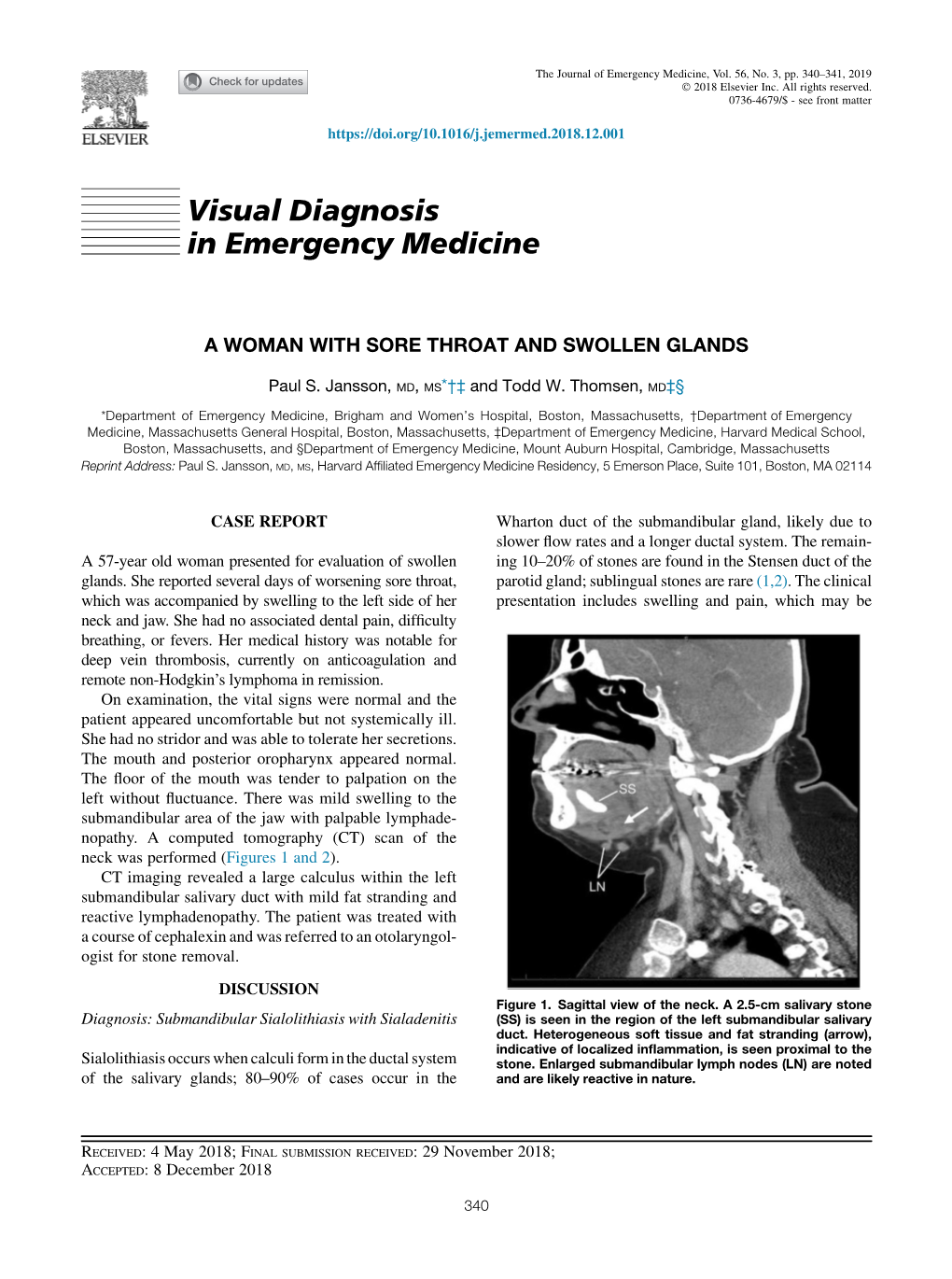 A Woman with Sore Throat and Swollen Glands