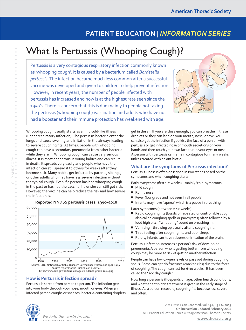 What Is Pertussis (Whooping Cough)?