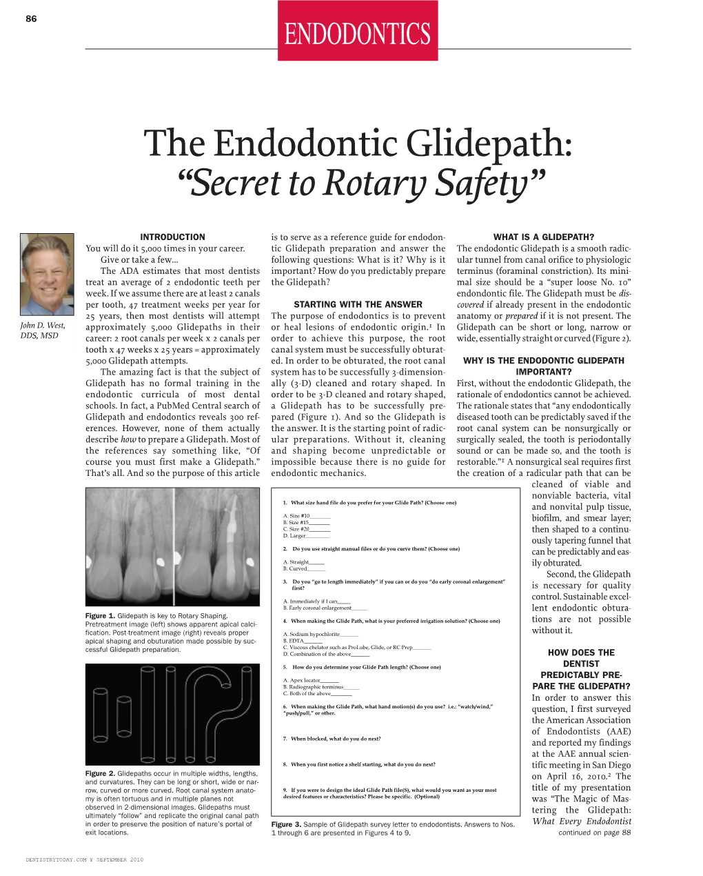 The Endodontic Glidepath: “Secret to Rotary Safety”