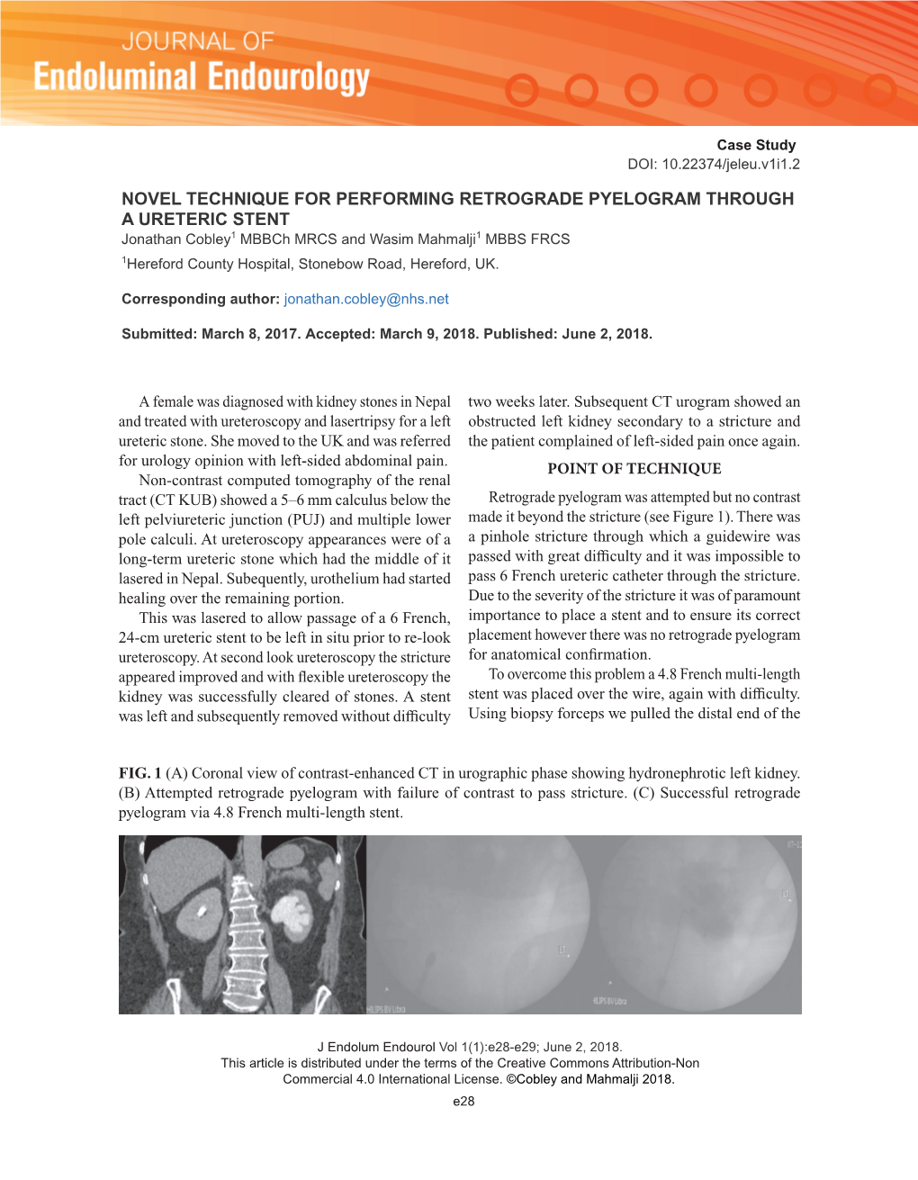 Novel Technique for Performing Retrograde Pyelogram Through A