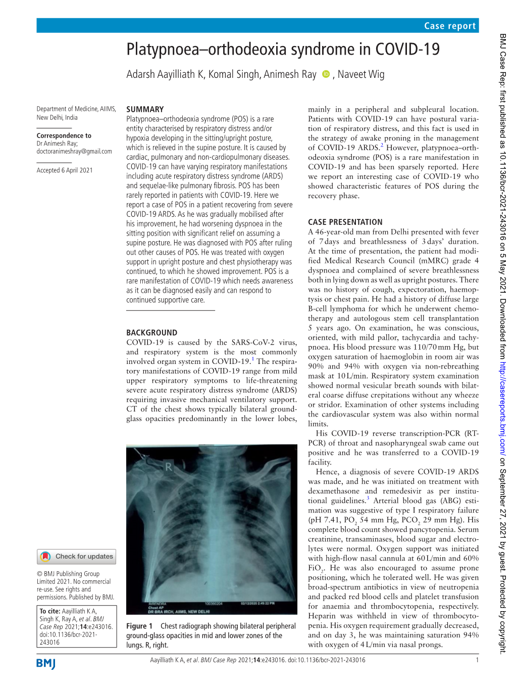 Platypnoea–Orthodeoxia Syndrome in COVID-19 Adarsh Aayilliath K, Komal Singh, Animesh Ray ‍ ‍ , Naveet Wig