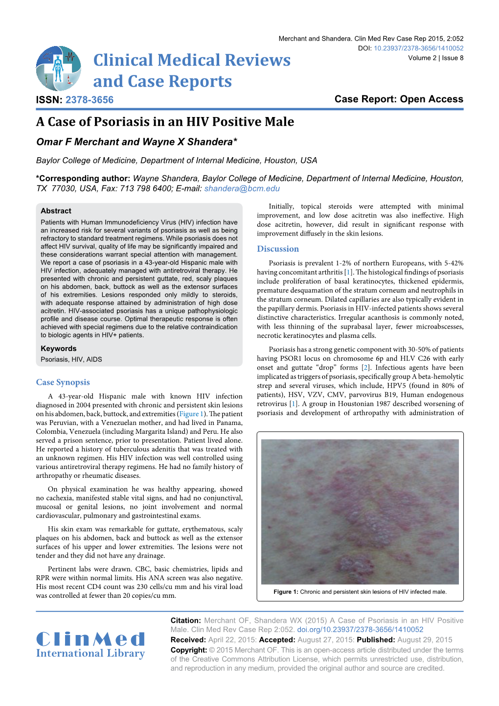 A Case of Psoriasis in an HIV Positive Male Omar F Merchant and Wayne X Shandera*