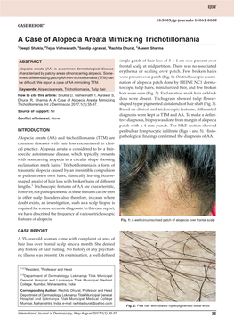 A Case of Alopecia Areata Mimicking Trichotillomania 1Deepti Shukla, 2Tejas Vishwanath, 3Sandip Agrawal, 4Rachita Dhurat, 5Aseem Sharma