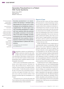Secondary Pseudoainhum in a Patient with Turner Syndrome Brady S