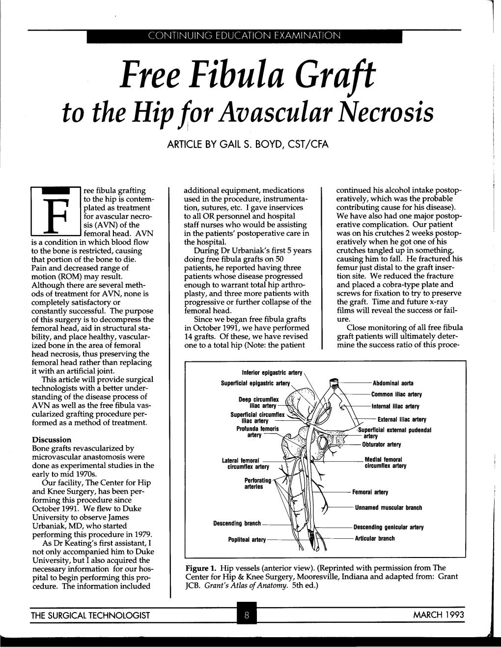 Free Fibula Graft to the Hip Fori Avascular Necrosis ARTICLE by GAIL S
