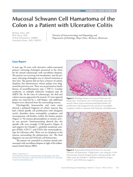 Mucosal Schwann Cell Hamartoma of the Colon in a Patient with Ulcerative Colitis