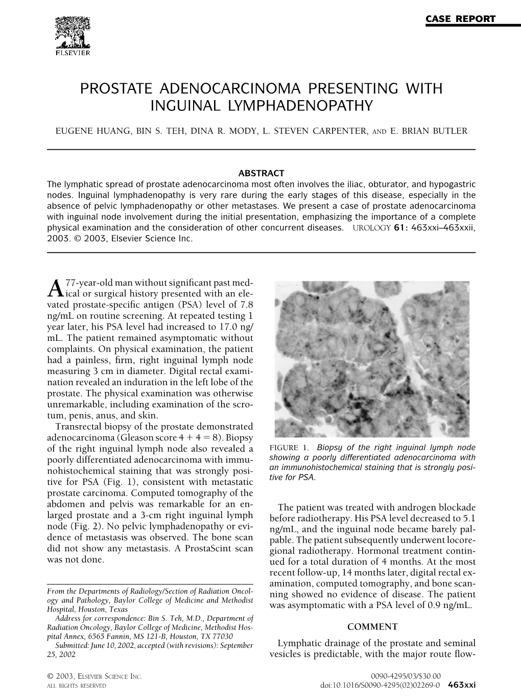 Prostate Adenocarcinoma Presenting with Inguinal Lymphadenopathy