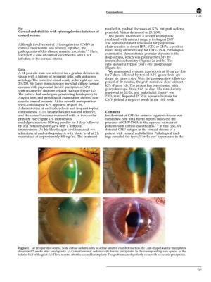 Corneal Endotheliitis with Cytomegalovirus Infection of Persisted