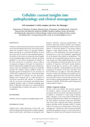 Cellulitis: Current Insights Into Pathophysiology and Clinical Management