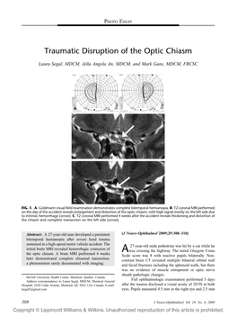 Traumatic Disruption of the Optic Chiasm
