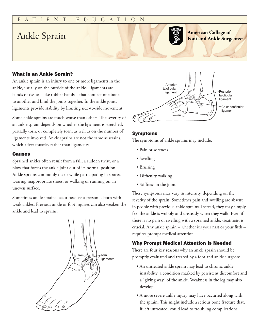 Ankle Sprain