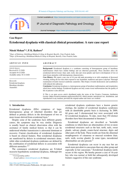 Ectodermal Dysplasia with Classical Clinical Presentation: a Rare Case Report