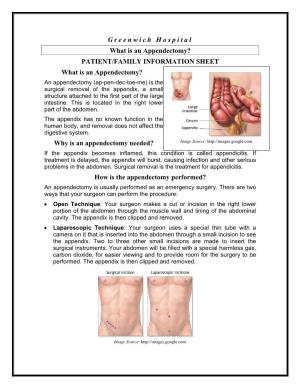 Greenwich Hospital What Is an Appendectomy?