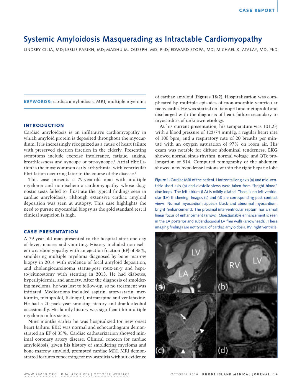 Systemic Amyloidosis Masquerading As Intractable Cardiomyopathy