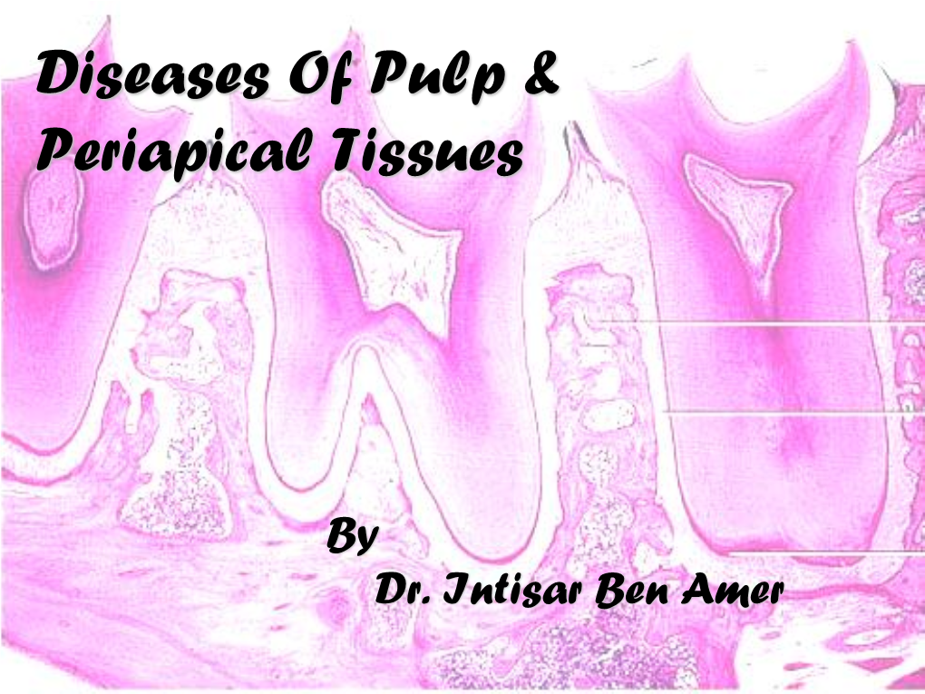 DISORDERS of the PULP & PERIPAICAL TISSUES Prepared By