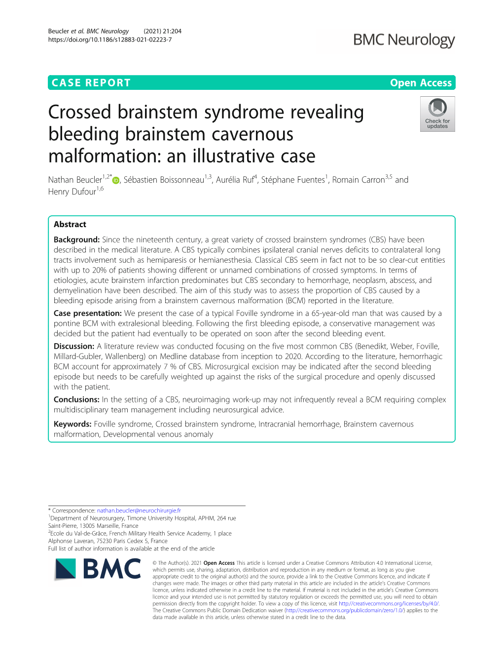 Crossed Brainstem Syndrome Revealing