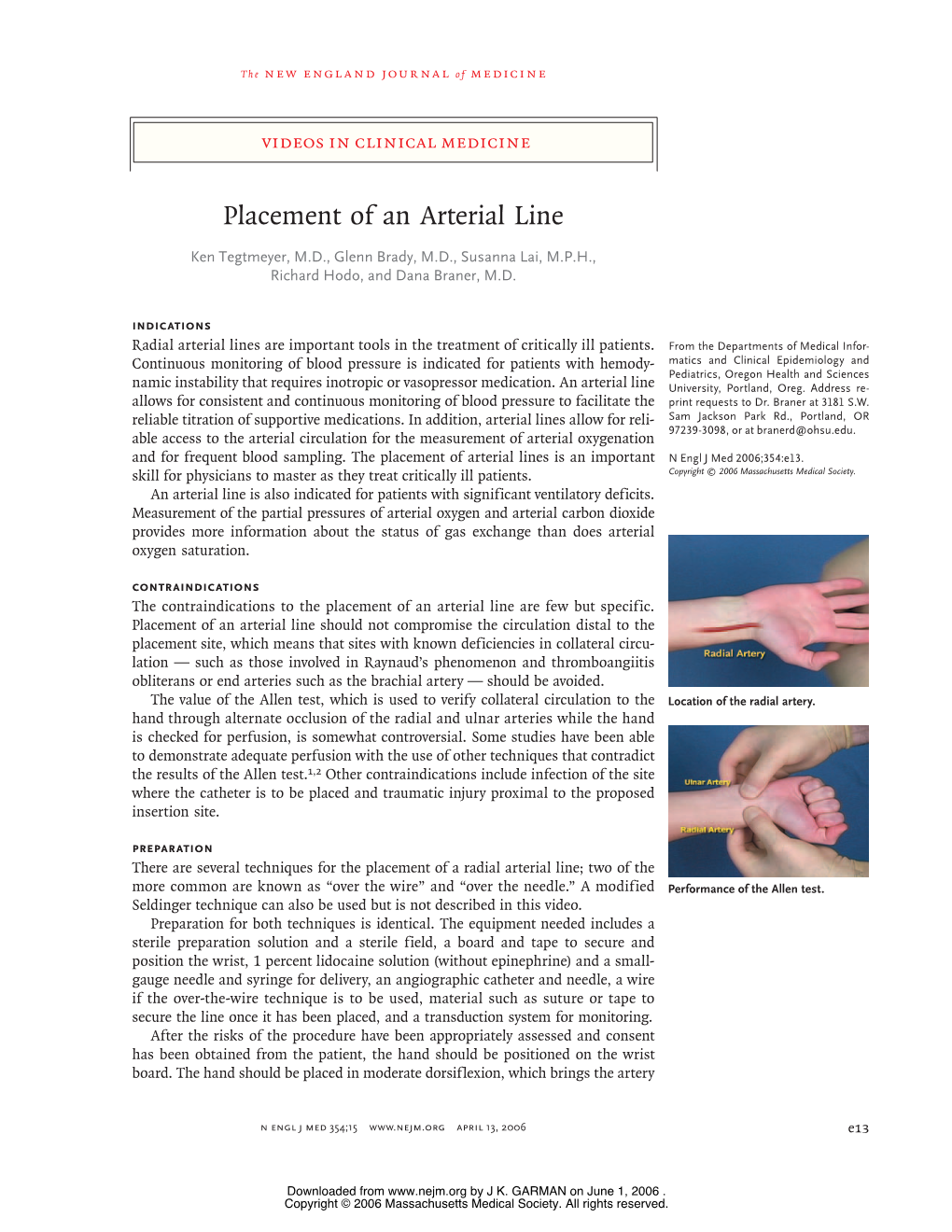 Placement of an Arterial Line