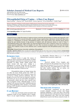 Fibroepithelial Polyp of Vagina – a Rare Case Report Sujata Kumbhar1*, Digvijay Patil2, Shoaib Khoja3, Garima Agarawal3, Divya Brahmbhatt3, Vaidehi Nagar3