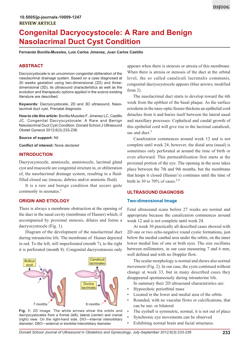 Congenital Dacryocystocele: a Rare and Benign Nasolacrimal Duct Cyst Condition Congenital Dacryocystocele: a Rare and Benign Nasolacrimal Duct Cyst Condition