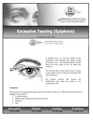 Excessive Tearing (Epiphora ))