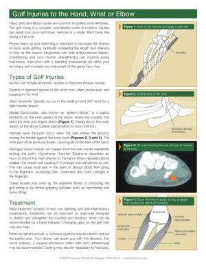 Golf Injuries to the Hand, Wrist Or Elbow