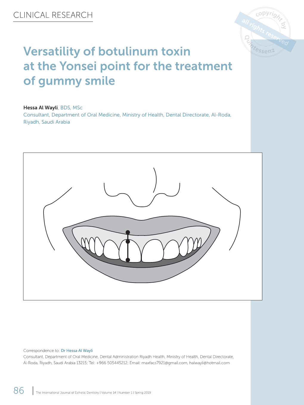 Versatility of Botulinum Toxin at the Yonsei Point for the Treatment of Gummy Smile